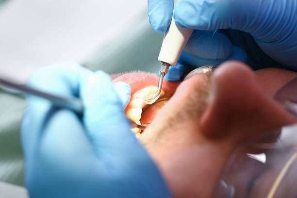 Best Dentist for Tooth Abscess  in Watertown, SD
